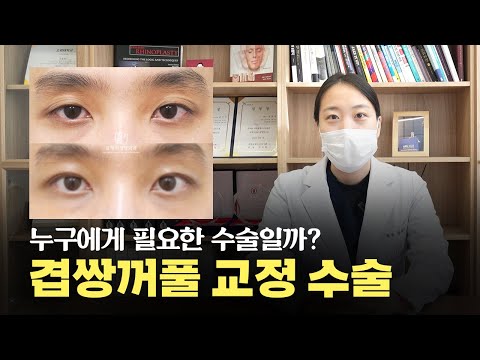 여러 겹 쌍꺼풀? 졸려 보이기까지? 어떻게 해결해야할까?