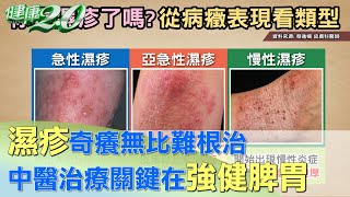 體內濕氣重！濕疹反覆發作 根治關鍵在強健脾胃 健康2.0