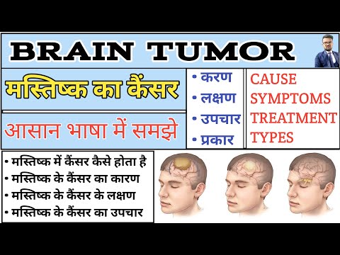 Brain Tumor in hindi | मस्तिष्क का कैंसर | Brain Tumor Types | Brain Tumor Treatment | Symptoms