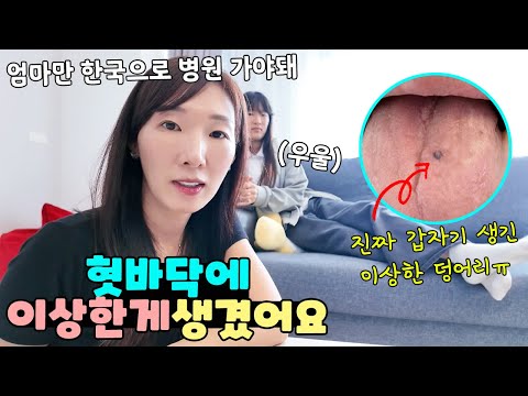 혓바닥에 검정색 이상한게 생겼는데 이거 뭐예요?ㅠ 가족 일상 브이로그 vlogㅣ토깽이네