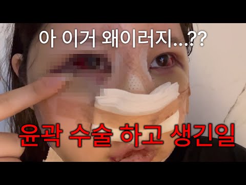 성형 수술 부기 이렇게 뺐어요😂🤣 달리는 차에서 일어난 일 [혜주Vlog]