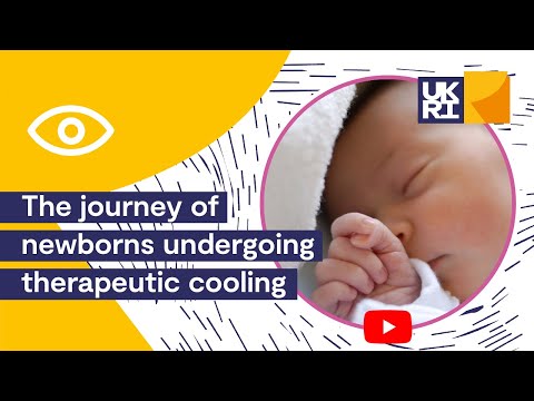 The Golden Window Trailer | The Journey of #Newborns Undergoing #Therapeutic Cooling