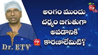 What Are The Causes Of Skin Tightening In Penis Foreskin? | Dr.ETV | 3rd Dec 2022  | ETV Life