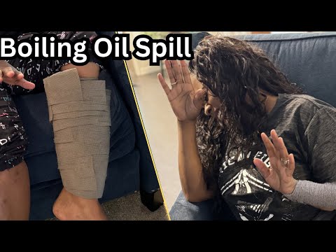 Hot Boiling Oil Spill Disaster! 😱🔥"