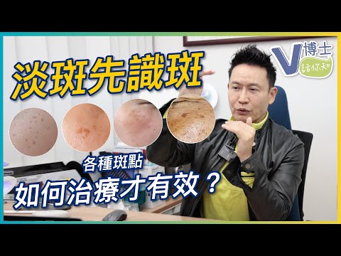 淡斑先識斑（各種斑點） 如何治療才有效？【V博士話你知】