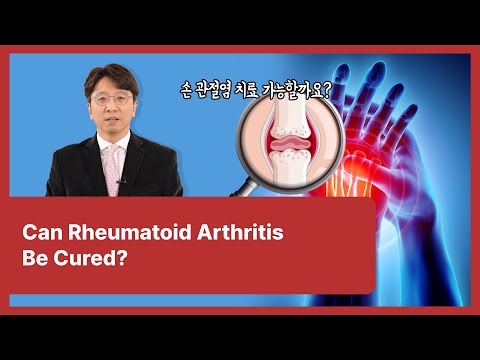 04 Can Rheumatoid Arthritis Be Cured?