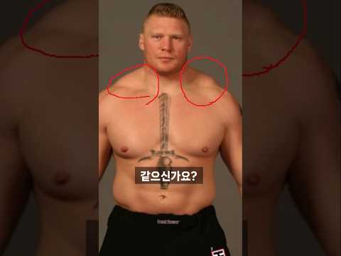 보톡스 없이 승모근 줄이는 방법