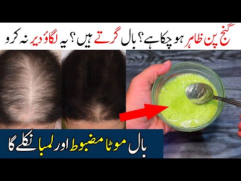 Long Hair Secret Remedy - Extreme Hair Growth Home Remedy - Desi Health Tv Remedies