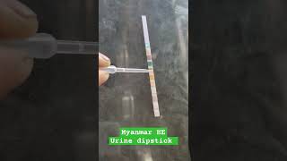 Urine dipstick 11 parameter testing #education #mbbs #urine_infection #urine