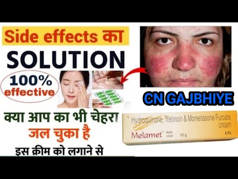 Melamet Cream | Melamet cream ke sideeffects kaise thik kare | Melamet cream cream side effect