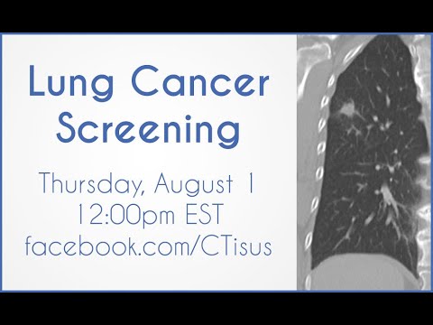 Facebook Live: Lung Cancer Screening