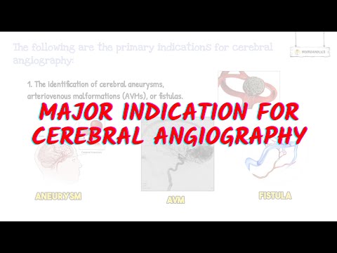 Unrevealing the Indication of Cerebral DSA for Precision Diagnosis