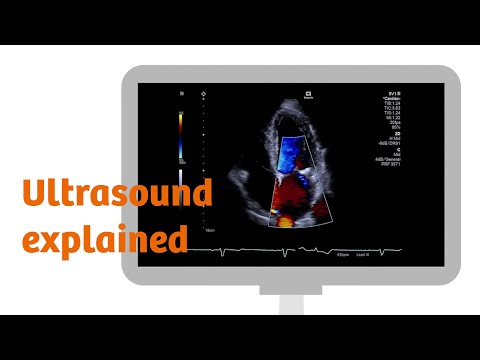 Ultrasound explained: how does it work?