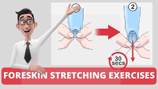 #4 Phimosis (Tight Foreskin) Exercises: FIVE Foreskin stretching exercises you can try at home