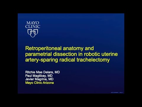 Retroperitoneal anatomy and parametrial dissection in robotic uterine artery-sparing radical trachel