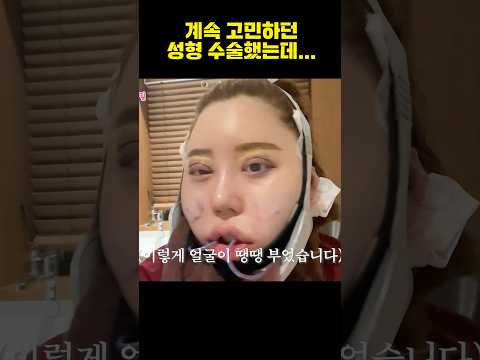 윤곽 수술이 정말 큰 수술이구나...#shorts