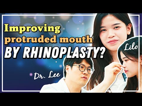 So rhinoplasty can improve my protruded mouth?!😱  | Q&A session with Lilo and Dr. Lee!