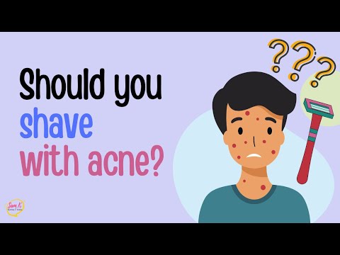 Should I shave my face if I have ACNE? Puberty Stages