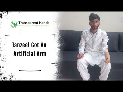 Tanzeel got an Artificial Arm