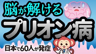 【衝撃】脳がスポンジになるプリオン病とは？合わせて狂牛病との違いも解説