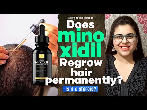 Does Minoxidil Regrow hair permanently? Minoxidil side effects. Minoxidil results. Hair fall