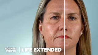 Scientists Are Closer Than Ever To Reverse Aging. How Does It Work? | Life Extended