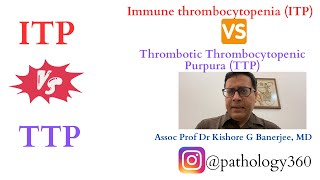 TTP (Thrombotic Thrombocytopenic Purpura) Versus ITP (Immune thrombocytopenia) : the key concepts.