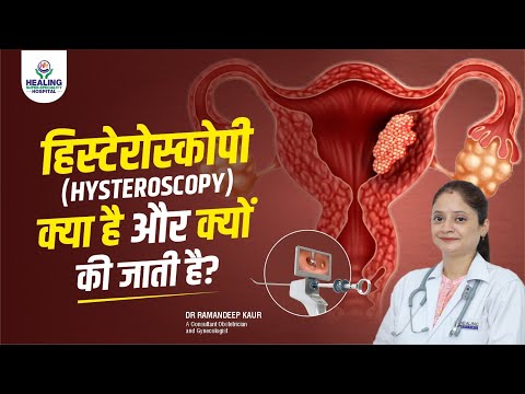 Hysteroscopy के बारे में संपूर्ण जानकारी । कैसे करते हैं ? क्यों करते हैं?