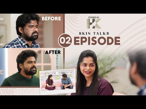 Skin Talks || episode 2 || Hyper pigmentation ||Stories by HK || Harshitha karthik