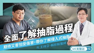 抽脂｜剖析抽脂原理 醫師帶你了解抽脂手術過程（含抽脂手術影片） ft.整型外科王祥亞、賴釗毅醫師【ME美醫誌】