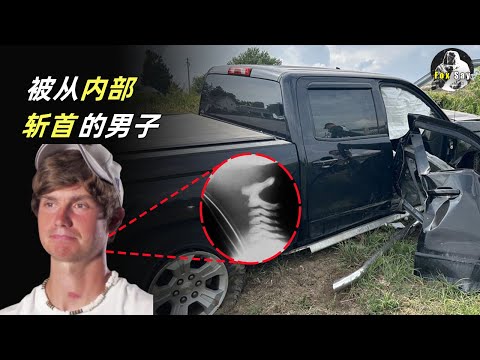 被从内部斩首的男子，一次次完美的和死神擦肩而过。