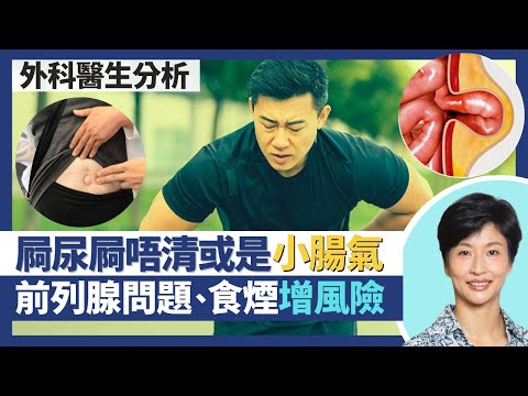 小腸氣／疝氣｜小腸氣＝肌肉缺口令器官移位！小便常去不清可能是小腸氣膀胱移位？前列腺問題、食煙、洗腎可增腹股溝疝風險？｜王建芳醫生 外科醫生楊丕祥醫生｜人類健康研究所