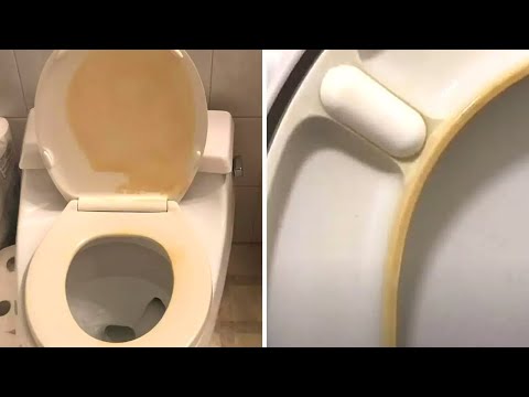 How to remove yellow stains from a toilet seat?