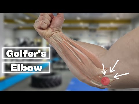 5 BEST Exercises For Golfers Elbow Rehab! [TRY THESE!]