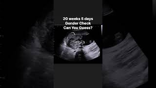 20 weeks 5 days Gender Check #jerbearimaging #genderreveal #girlorboy #boyorgirl #fyp