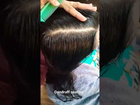 #dandruff #dandrufftreatment #dandruffseating #Rizawanatheba #makeup #parlour #hairstyle