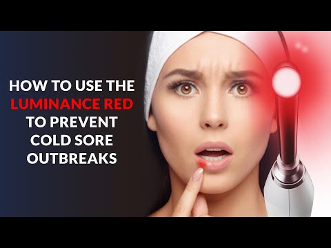 How to use the Luminance RED to Prevent Cold Sore Outbreaks (Cold Sore Laser Treatment)