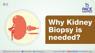 Why Kidney Biopsy is needed? | PACE Hospitals #shortvideo #kidneydiseasetreatment