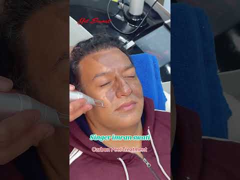 Carbon Peel Treatment #getsmarthairclub #viralvideo