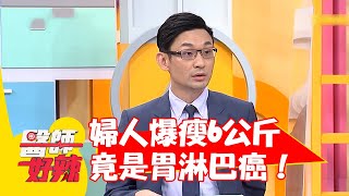 胃痛就買成藥吃..婦人爆瘦6公斤竟是胃淋巴癌！ 【#醫師好辣】20220721 part2 EP1377 蔡逸姍 陳榮堅 熊熊 阿Ben