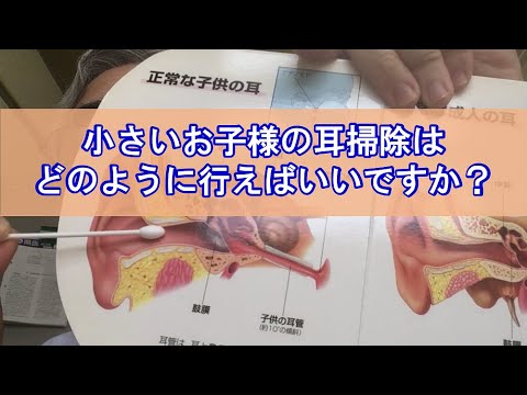 小さいお子様の耳掃除はどのように行えばいいですか？