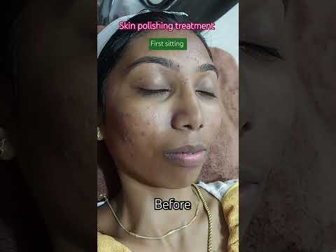 Skin polishing treatment/skin care #shorts #youtubeshorts