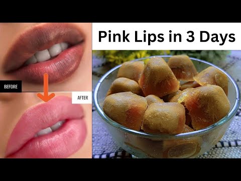 Pink Lips In 3 Days👄 | Natural Pink & Plump Lips @Hinaya