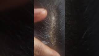 #shorts | curry leaves hair oil | Hair Growth Tips | Hair Growth | Curry leaves for hair growth