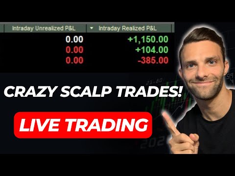 Master The Art Of Scalping Options