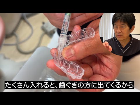 【ホームホワイトニング】自宅で行うホワイトニングについて解説します。