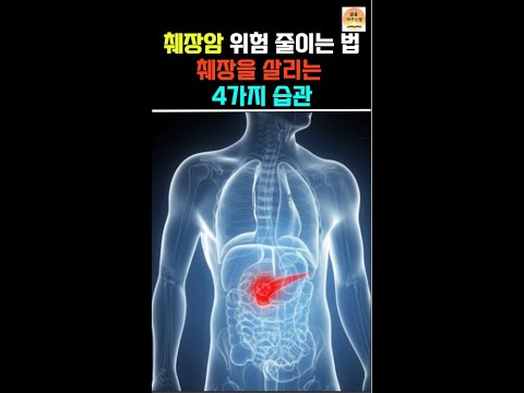 췌장암 위험 줄이는 법! 췌장을 살리는 4가지 습관