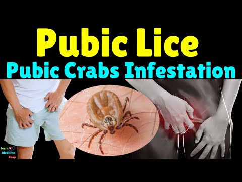 Pubic Lice Infestation (Pubic Crabs): Symptoms, Causes, Treatment, Complications & Prevention