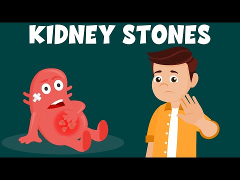 What causes kidney stones? | Kidney Stone Treatments | kidney Stone Removal