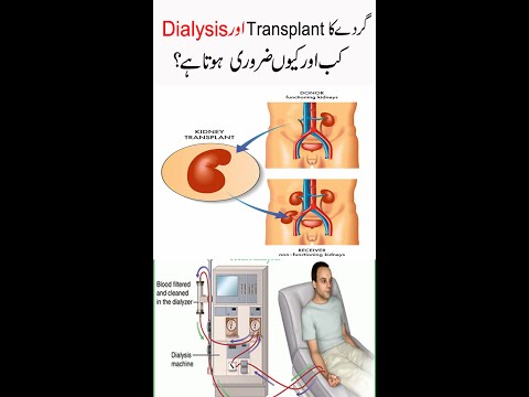 When & Why Kidney Transplant & Dialysis Are Necessary? | #dialysis #kidneyfailure #shorts #kidney